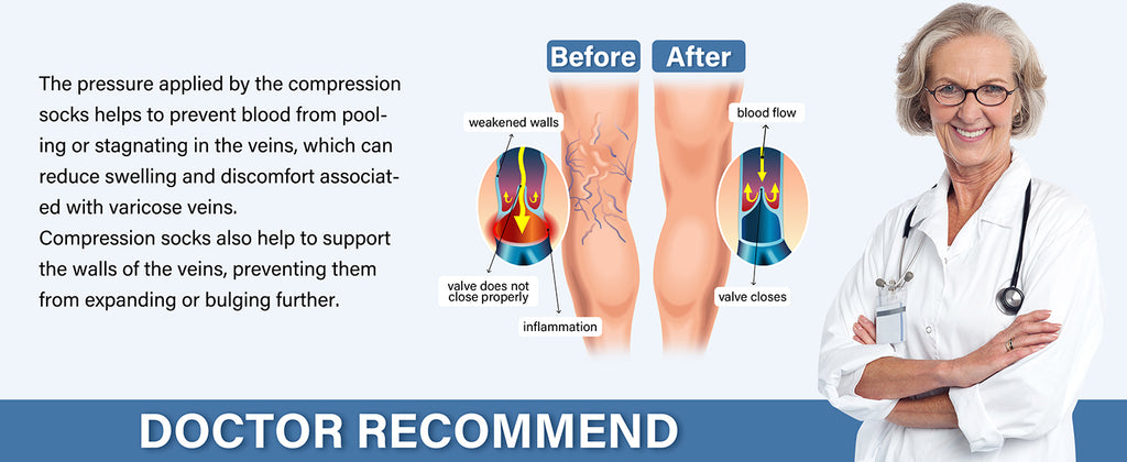 Women's & Men's Knee-High Compression Socks – 15–20 mmHg, 1 Pair